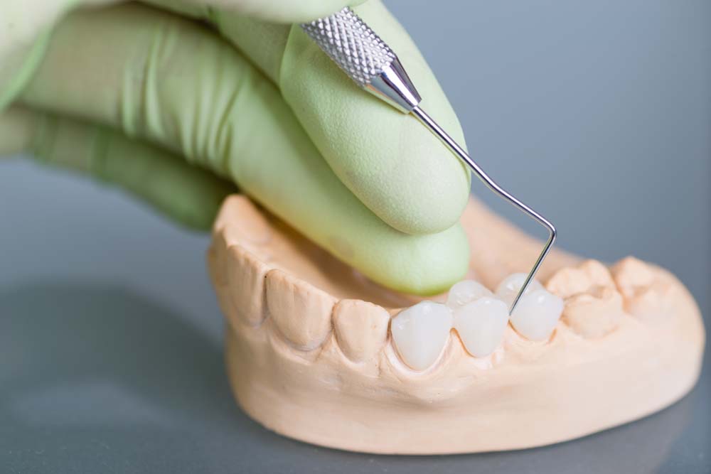 Closeup photo of a gloved hand using a metal pick on a model of teeth | featured image for General Dentistry.