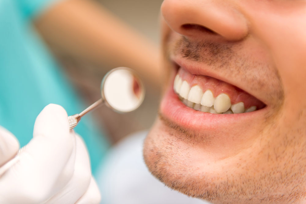Closeup photo of a smiling man with a dentist in the background holding a mirror | featured image for General Dentistry.